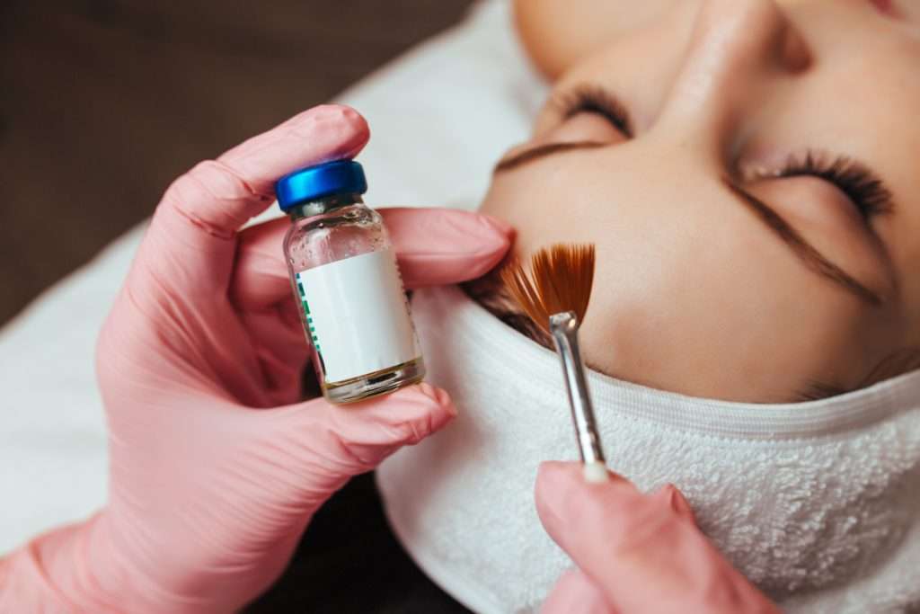 Acne Scarring Treatment Glasgow