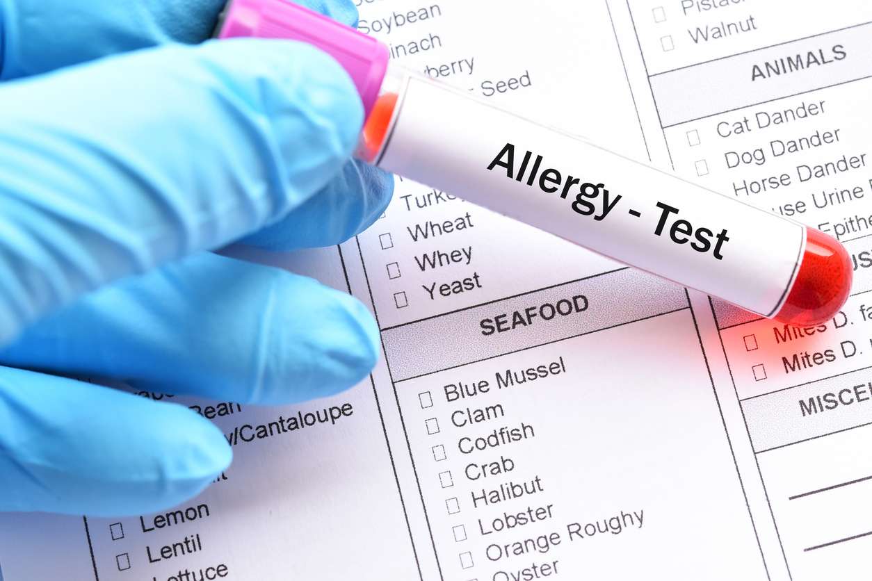 Allergy Testing vs Food Intolerance Testing